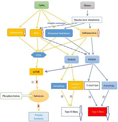 Type 2 diabetes mellitus related sarcopenia: a type of muscle loss distinct from sarcopenia and disuse muscle atrophy